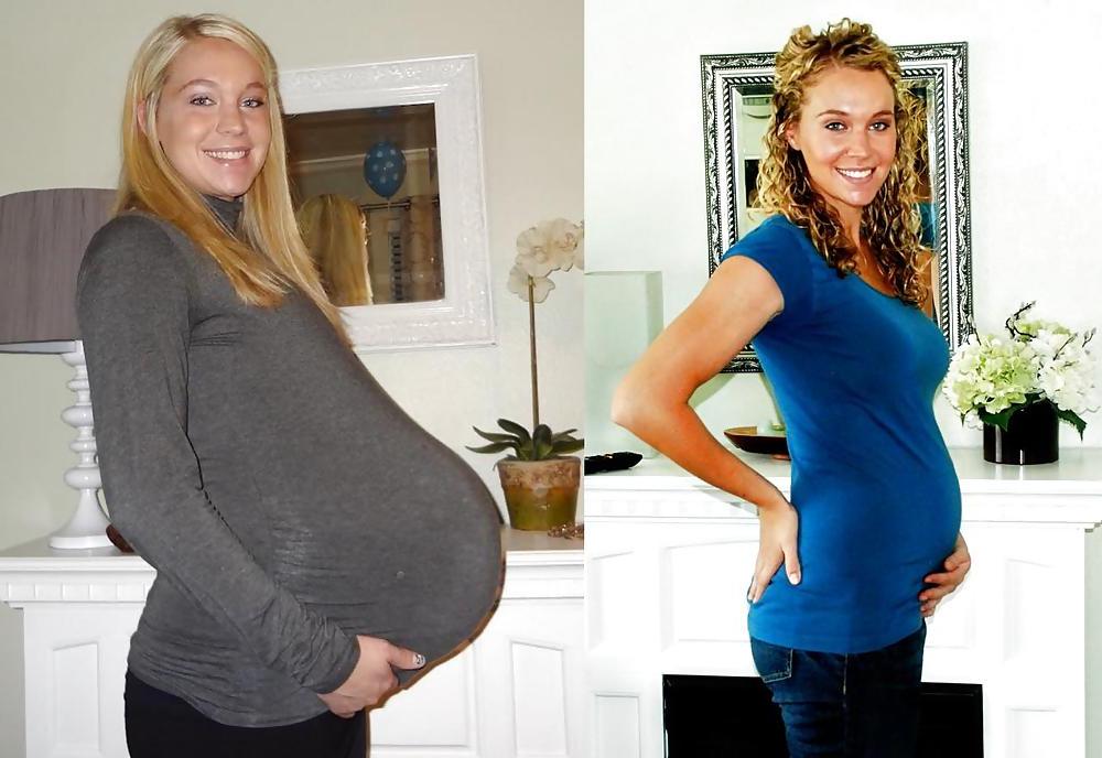 25P Before and After Pregnant Bellies