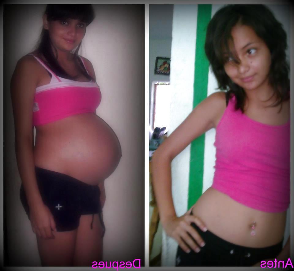 25P Before and After Pregnant Bellies