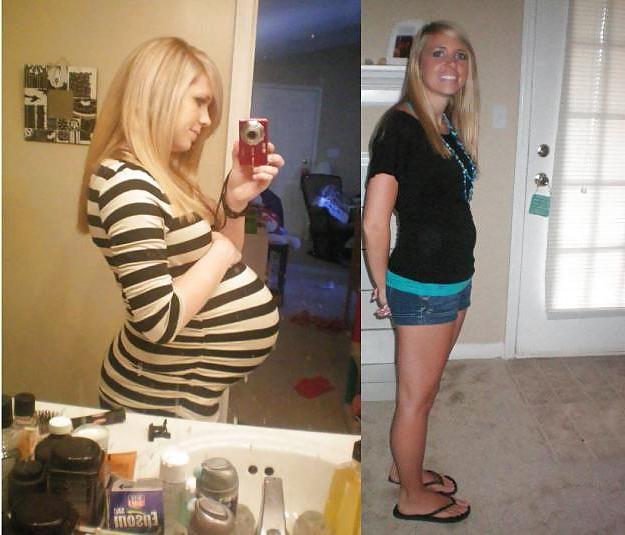 25P Before and After Pregnant Bellies