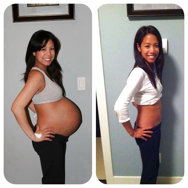 25P Before and After Pregnant Bellies
