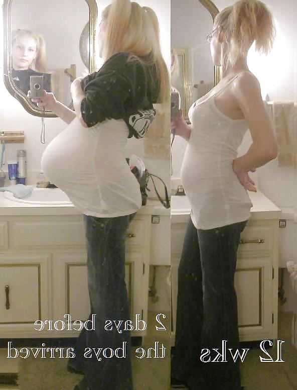 25P Before and After Pregnant Bellies