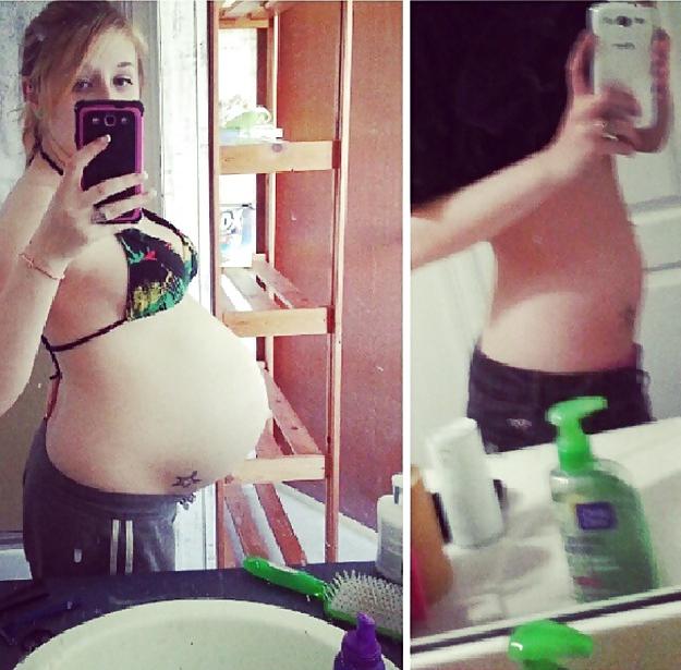 25P Before and After Pregnant Bellies