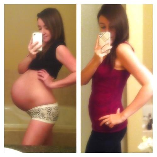 25P Before and After Pregnant Bellies