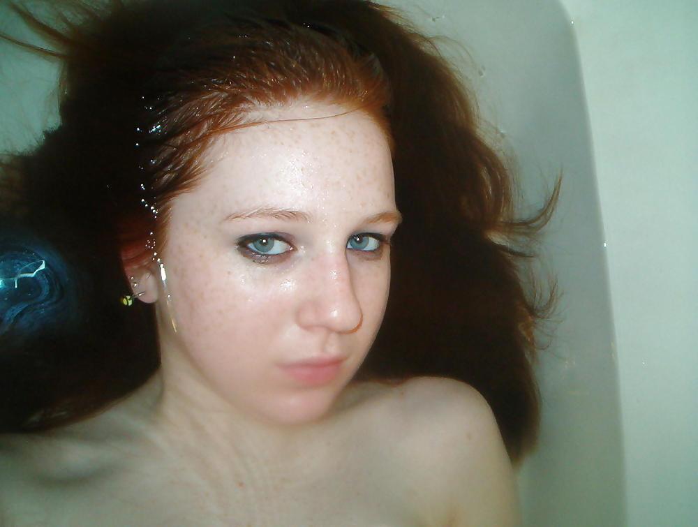 16P Cute Freckled Face