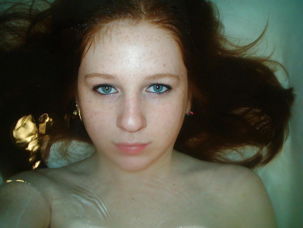16P Cute Freckled Face