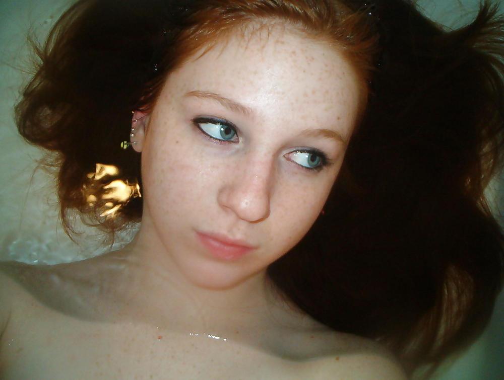 16P Cute Freckled Face