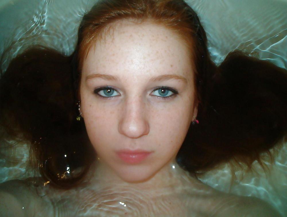16P Cute Freckled Face
