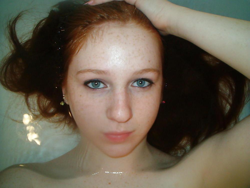 16P Cute Freckled Face