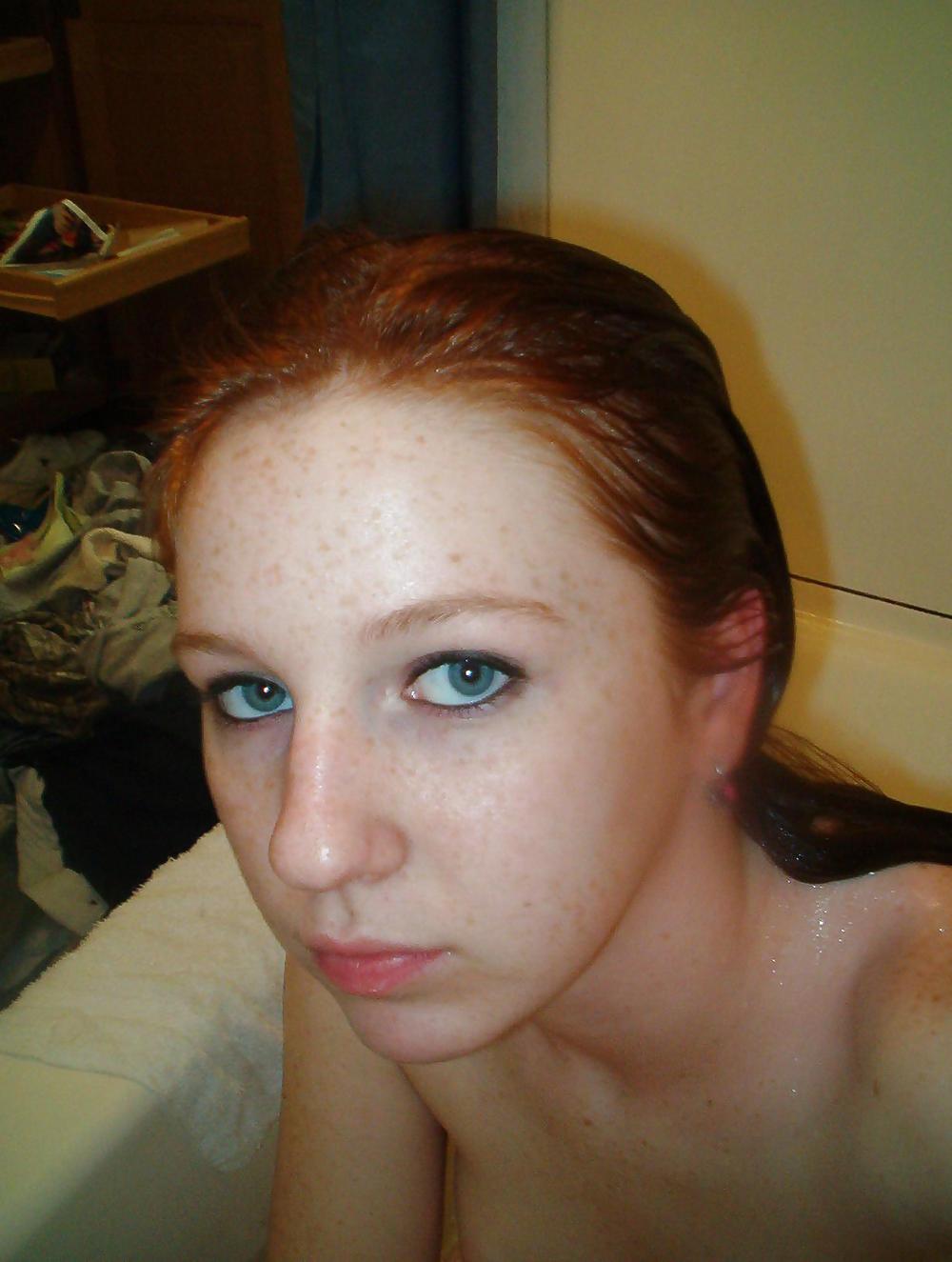 16P Cute Freckled Face