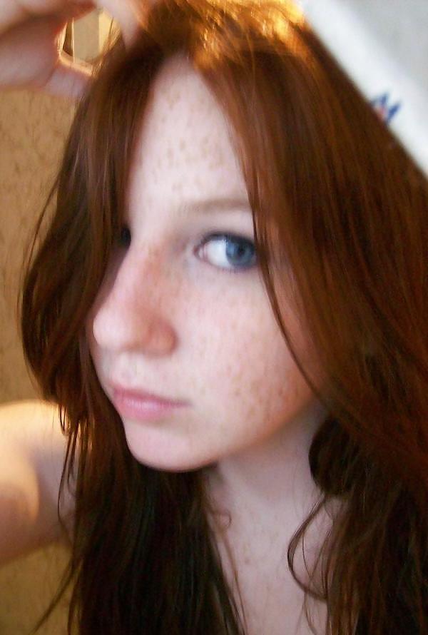 16P Cute Freckled Face