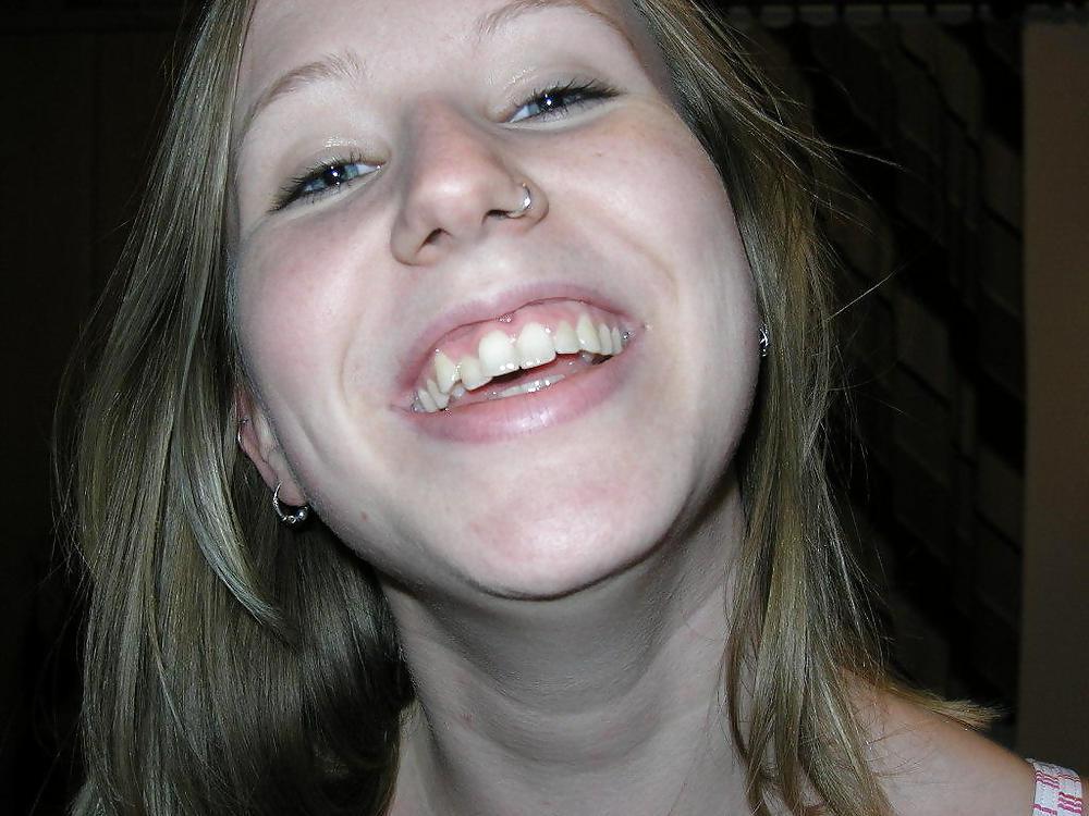 25P PRIVATE TEEN  I