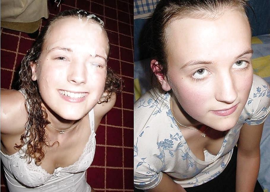20P Just Before And After Facials !