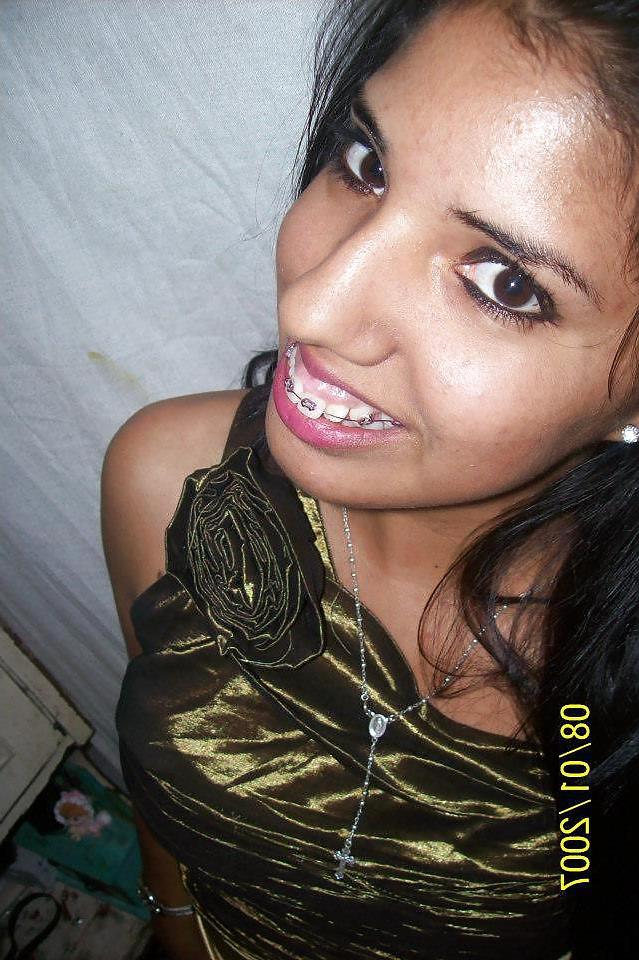 16P Valeria braces cocktease