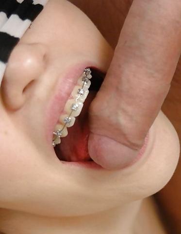 18P Cum on My Braces, Mister 2