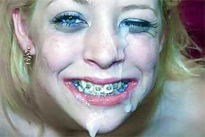 18P Cum on My Braces, Mister 2