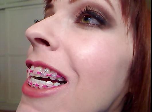 18P Cum on My Braces, Mister 2