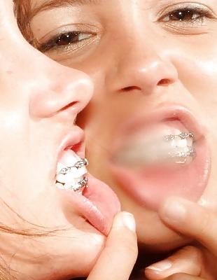 18P Cum on My Braces, Mister 2