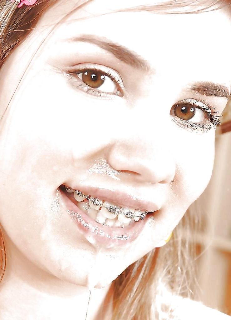 18P Cum on My Braces, Mister 2