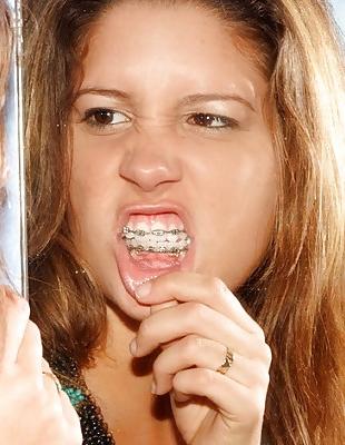 18P Cum on My Braces, Mister 2