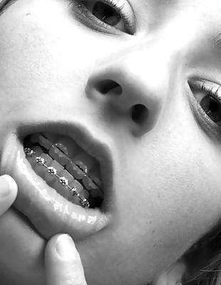 18P Cum on My Braces, Mister 2