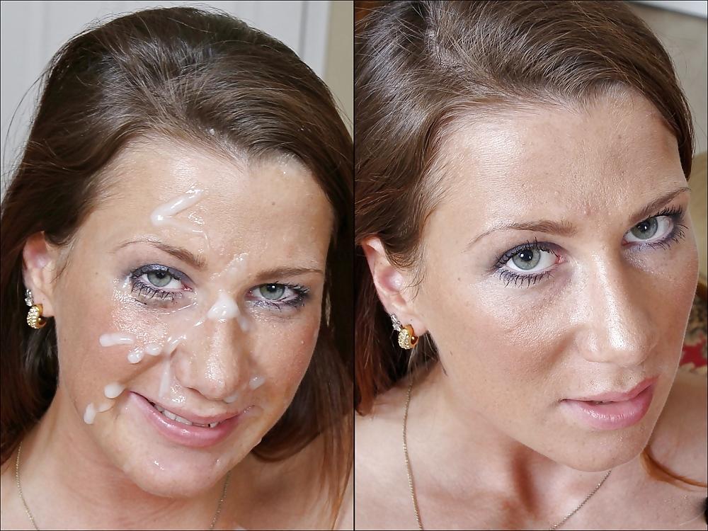 25P Before and After Facials 6 (Thumbs Up If You Like)