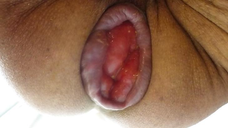 11P A gape cunt