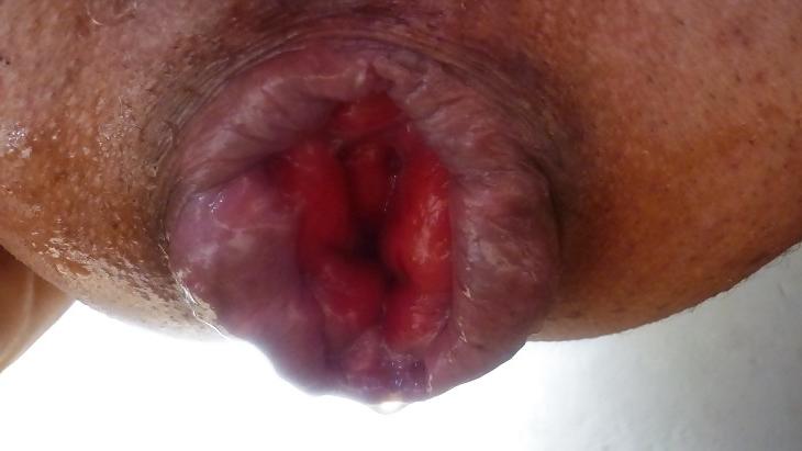 11P A gape cunt