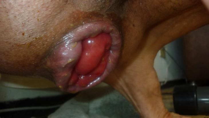 11P A gape cunt