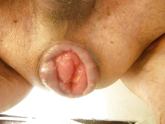 11P A gape cunt