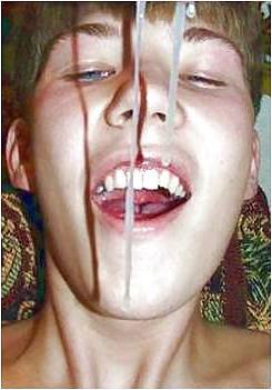 25P Facials