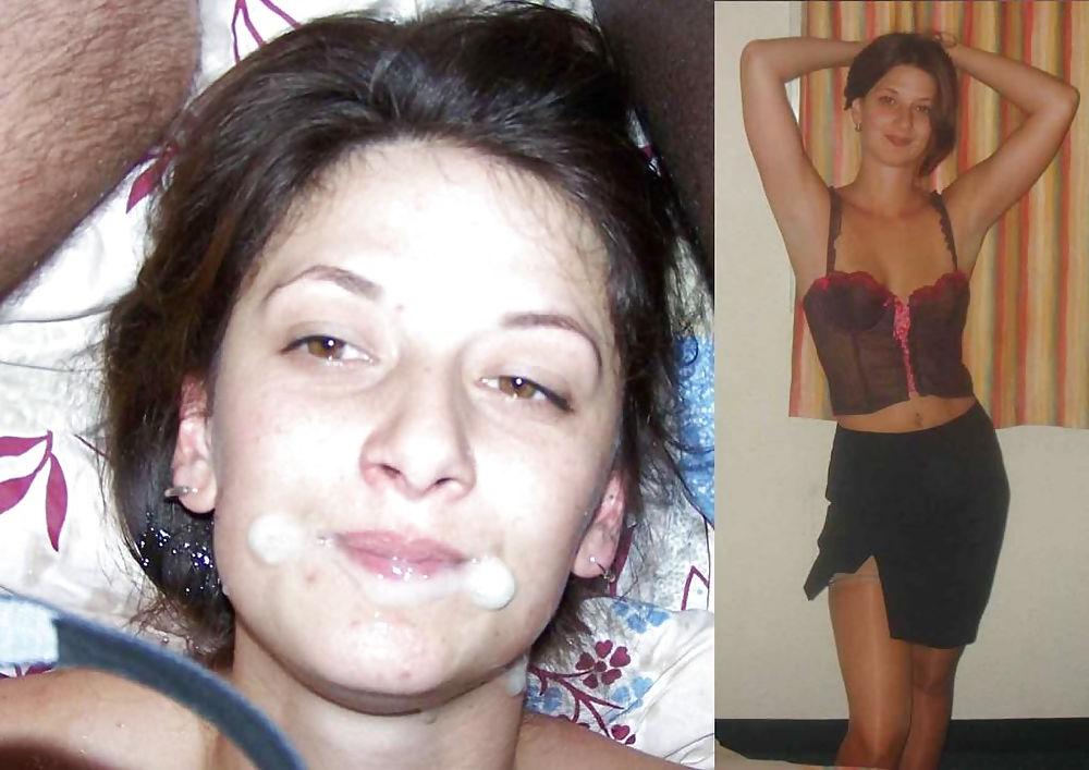 25P Before and After Facials 2