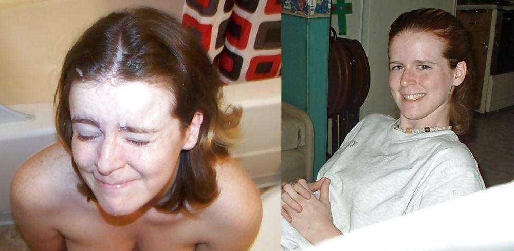 25P Before and After Facials 2