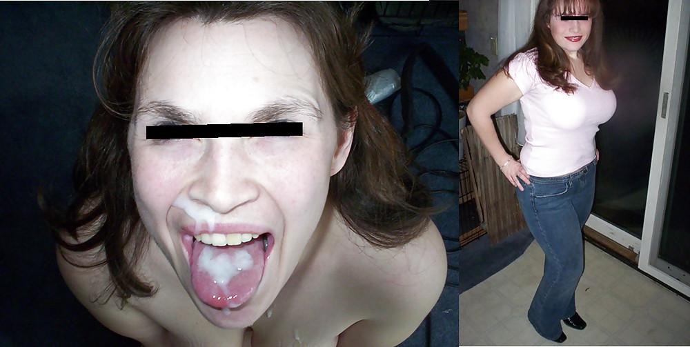 25P Before and After Facials 2
