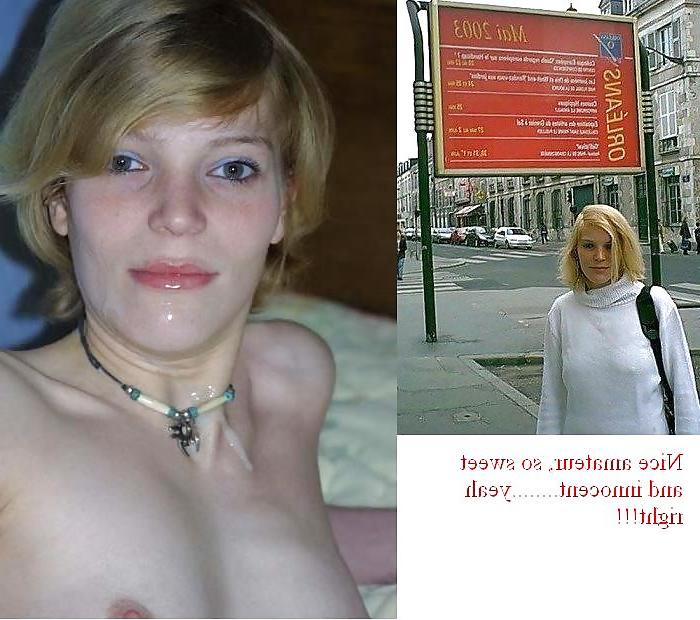 25P Before and After Facials 2