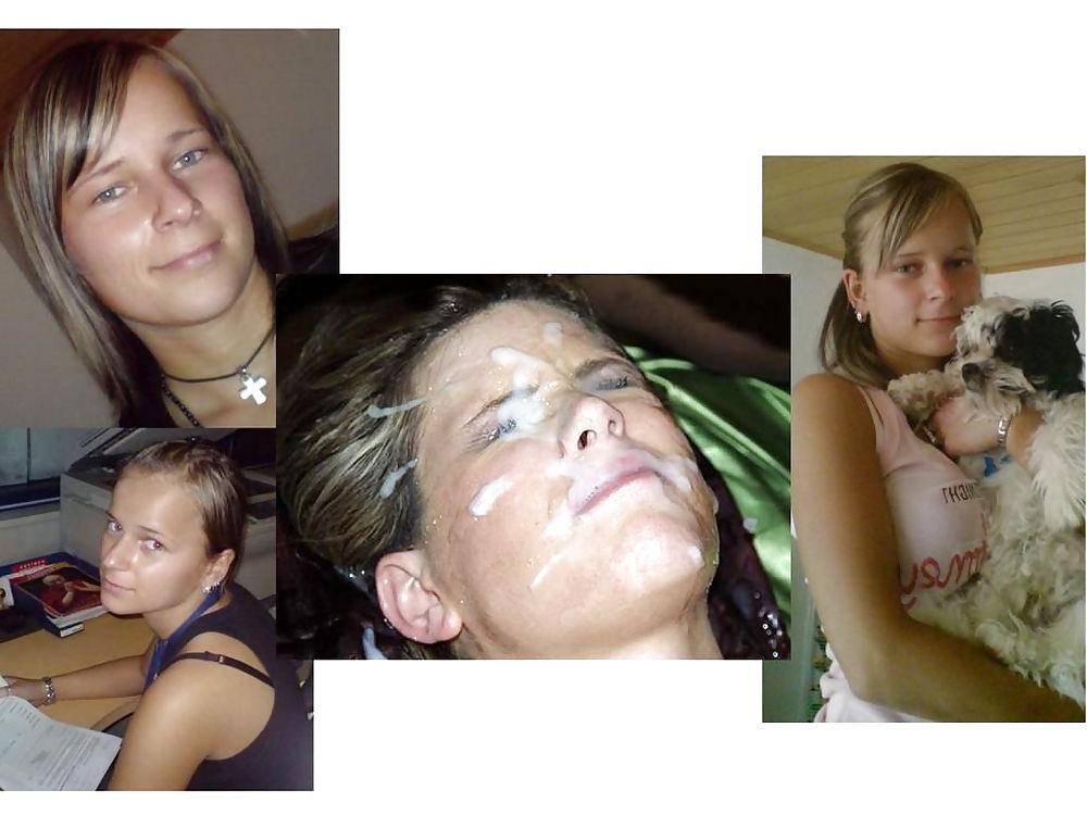 25P Before and After Facials 2