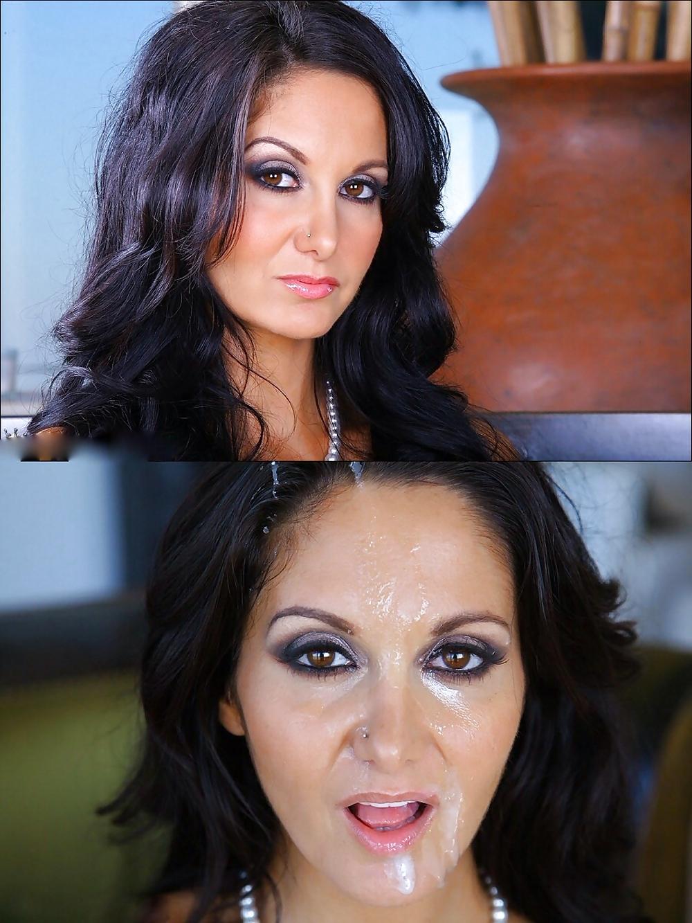 25P Before and After Facials 7 
