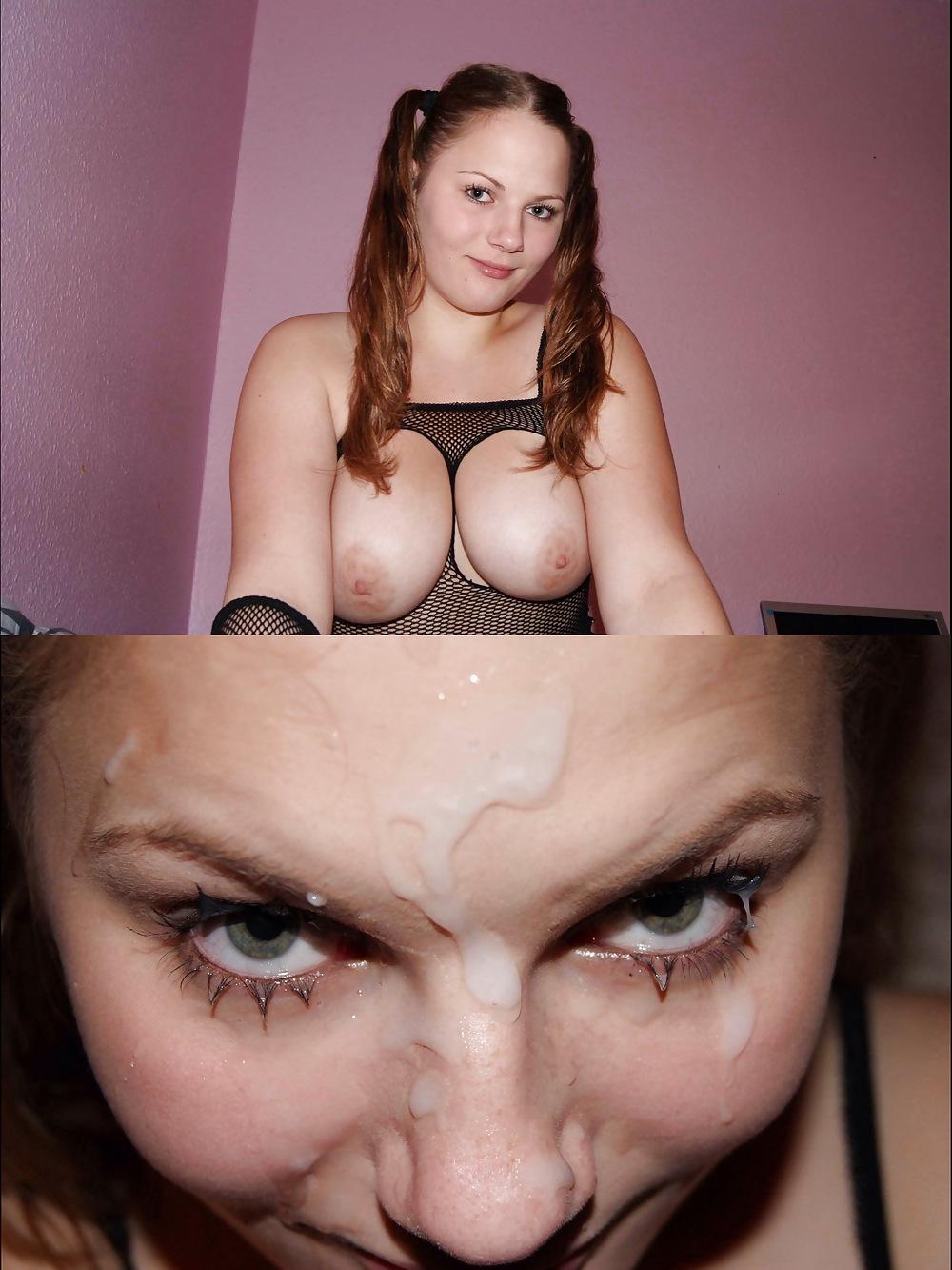 25P Before and After Facials 7 