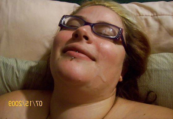 20P Weitere Gesichtsbehandlungen