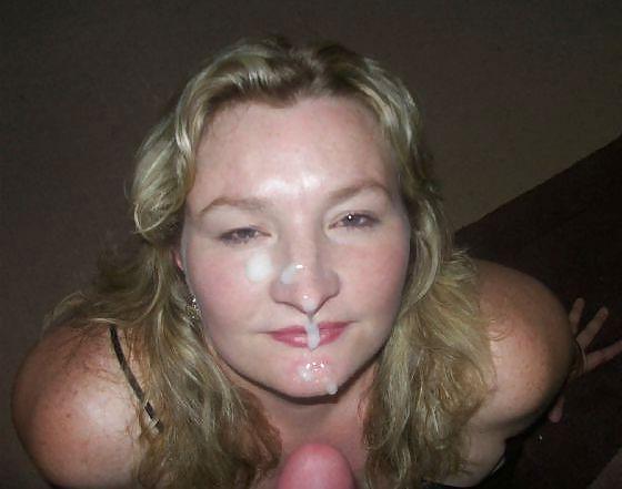 20P Weitere Gesichtsbehandlungen