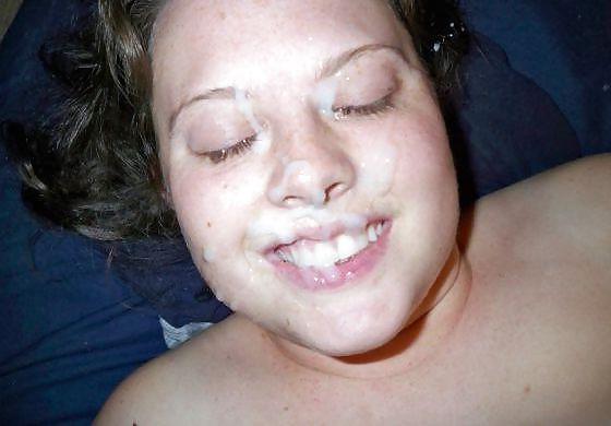 20P Weitere Gesichtsbehandlungen