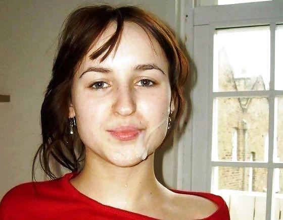 20P Weitere Gesichtsbehandlungen