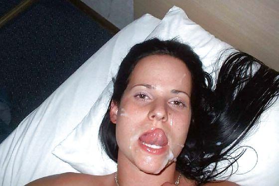 20P Weitere Gesichtsbehandlungen