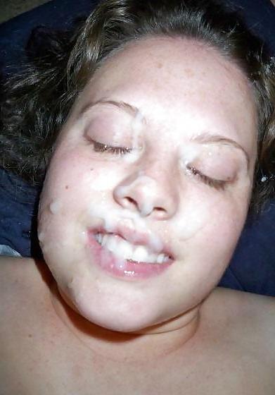20P Weitere Gesichtsbehandlungen
