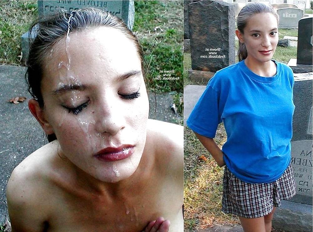 10P After before facials 3