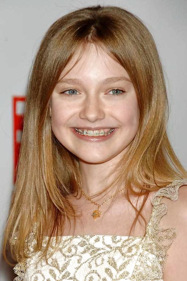 15P Girls with braces 1