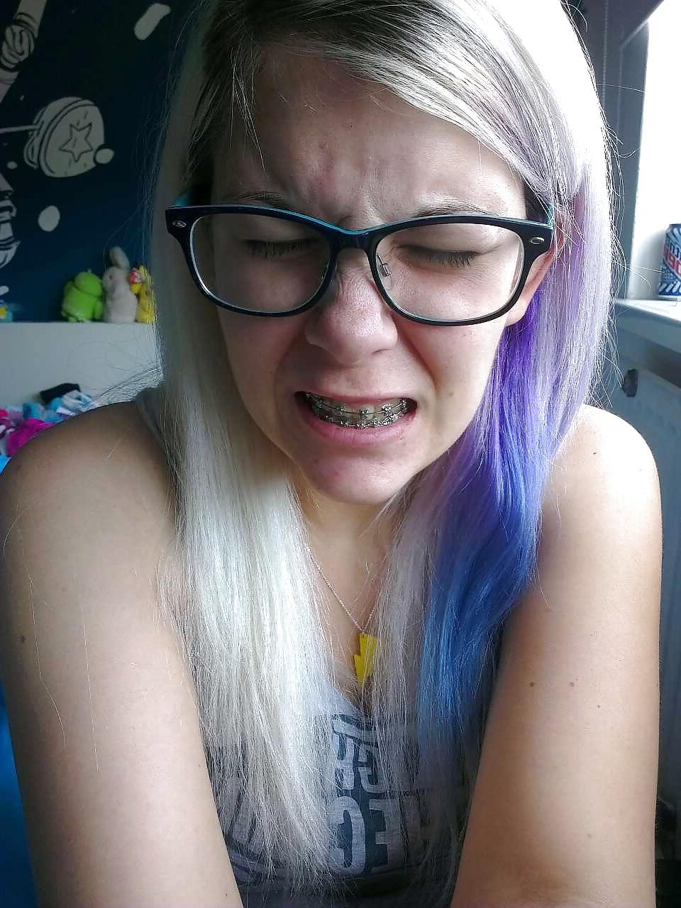 15P Girls with braces 1
