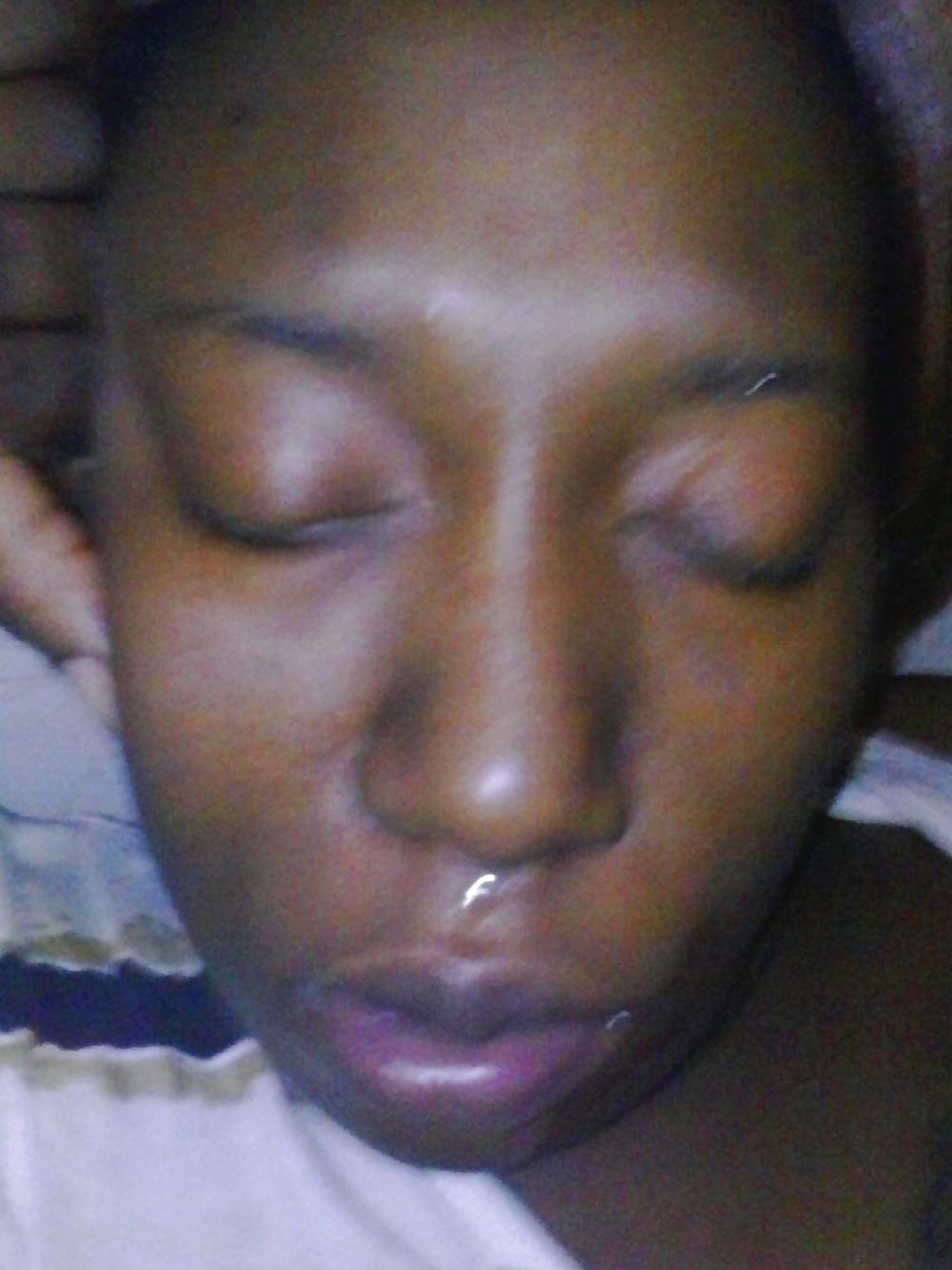 25P Facials