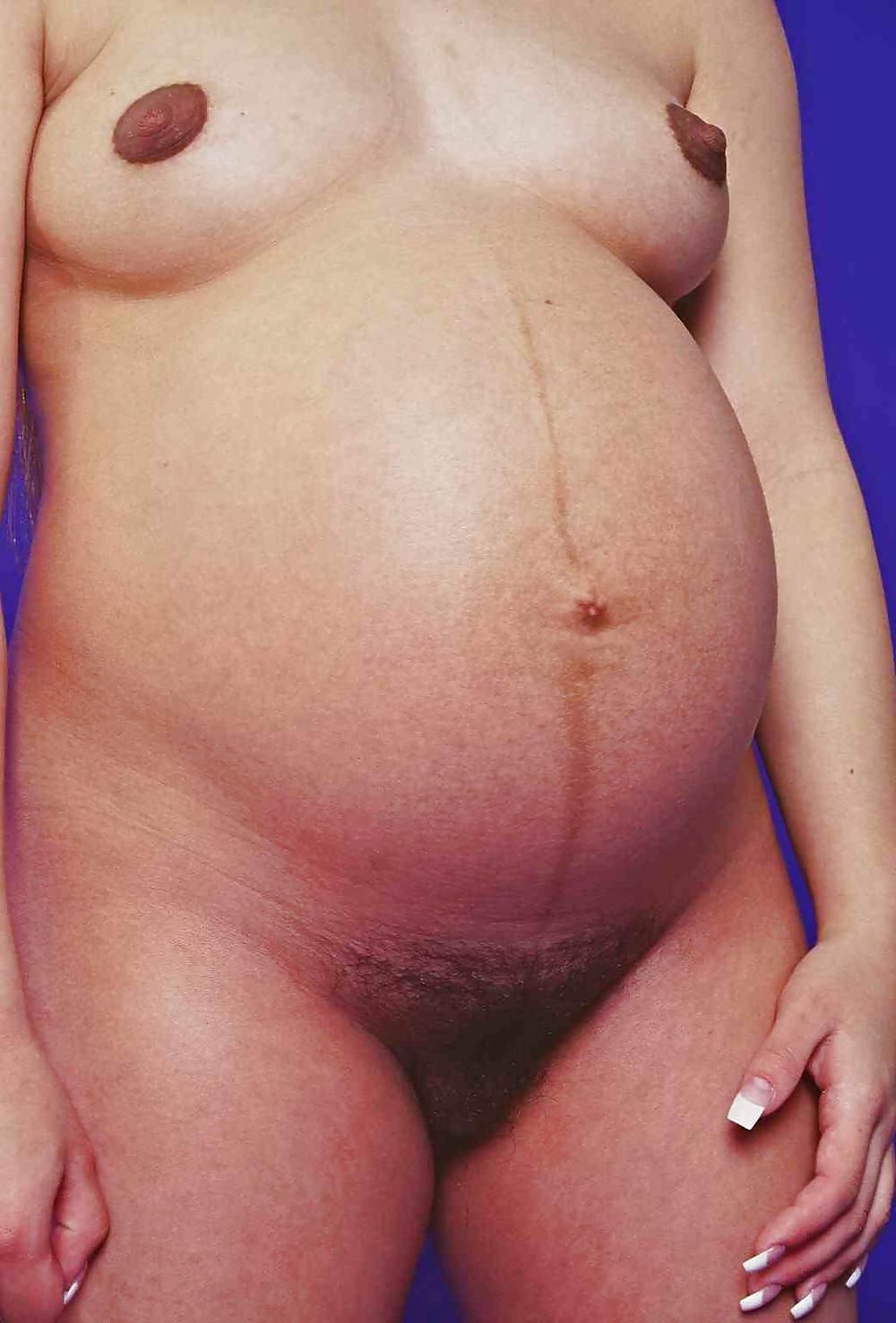 25P Young Teens Pregnant 