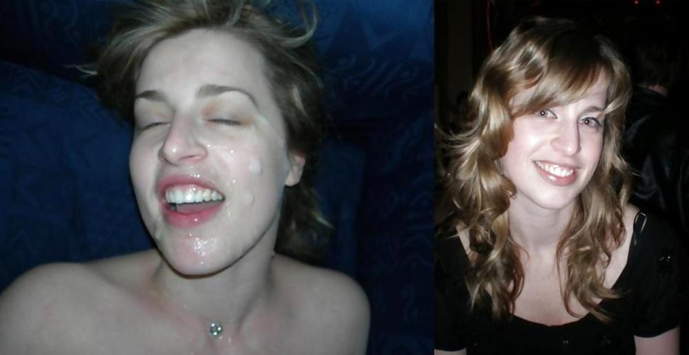 25P 120 befor and after