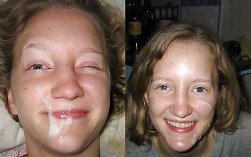 25P Facial 1